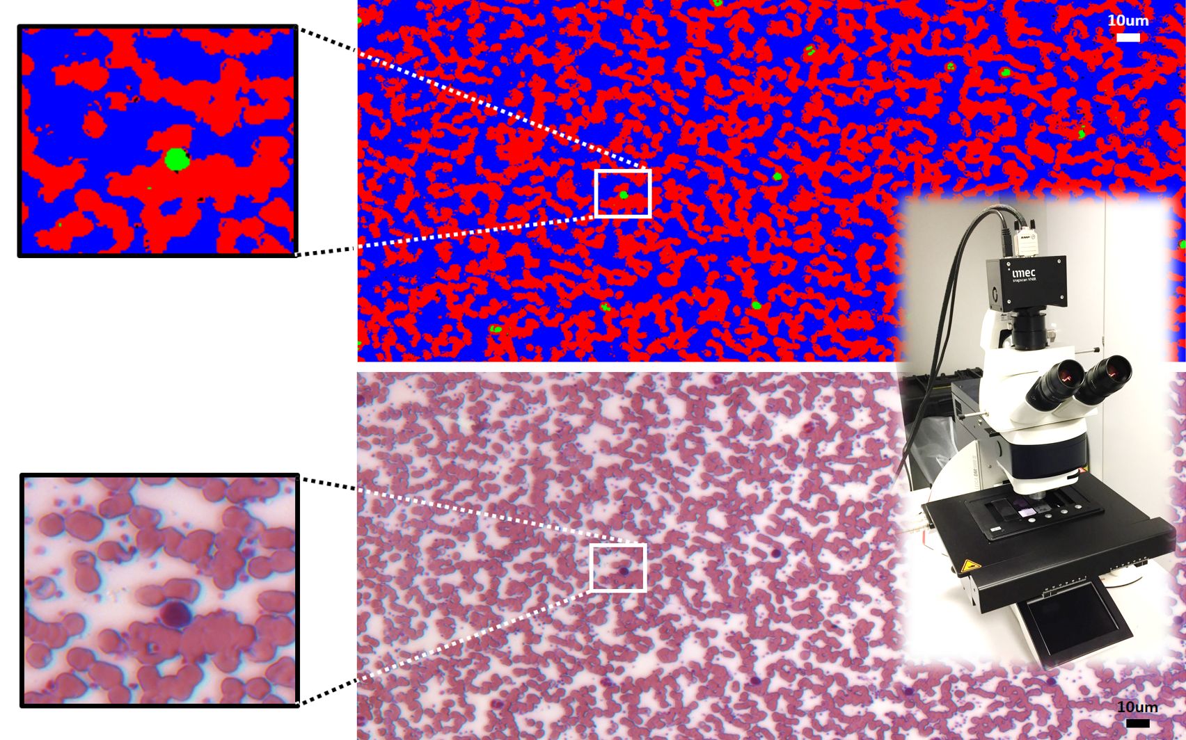 RGB rendering and classified image (red blood cells versus white blood cells) from a dataset of 150 spectral images of 7Mpx spatial resolution (snapscan VNIR camera was mounted onto a LEICA microscope for spectral imaging of a blood smear test